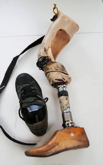 image of a used prosthetic leg